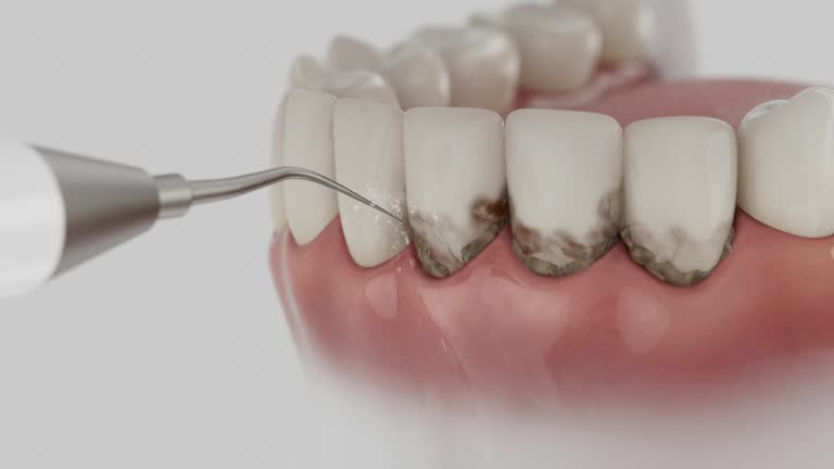Reliable Emergency Dentist contractor in Superior, NE by Smile Center Dentistry